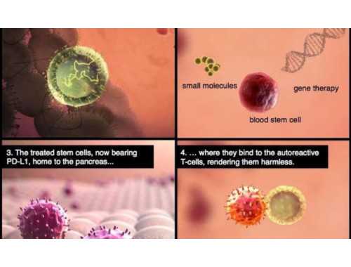 ASCT是适合移植老年NDMM患者安全有效的巩固治疗选择